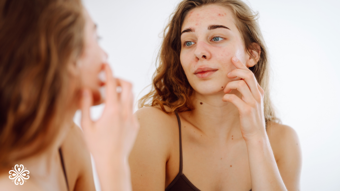 Does Mineral Makeup Cause Breakouts? The Truth About Mineral Foundation and Acne