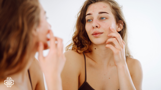 Does Mineral Makeup Cause Breakouts? The Truth About Mineral Foundation and Acne