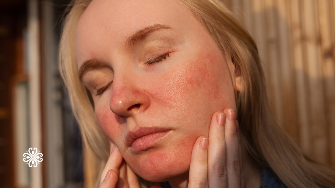 The Best Makeup for Rosacea in Australia (Gentle Options That Actually Work)