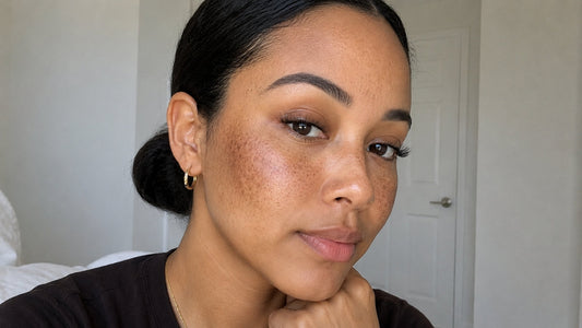 The Best Makeup for Hyperpigmentation: How to Cover Without Highlighting