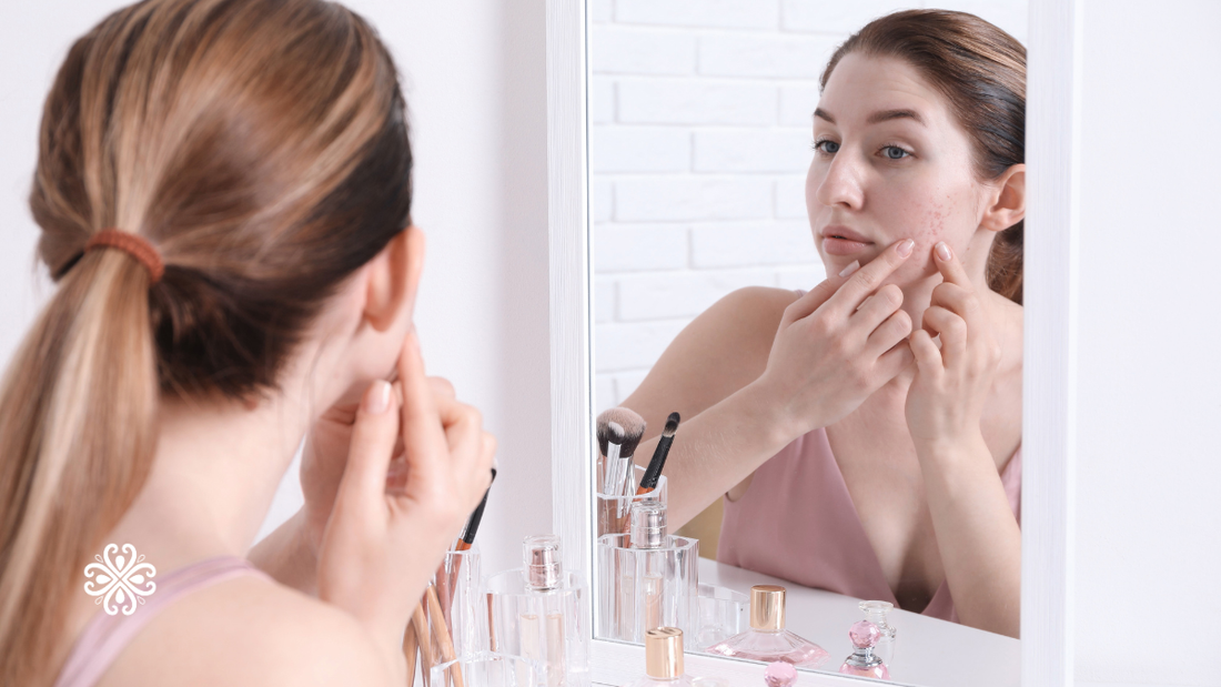 The Best Makeup for Hormonal Acne: Cover Without Causing More Breakouts